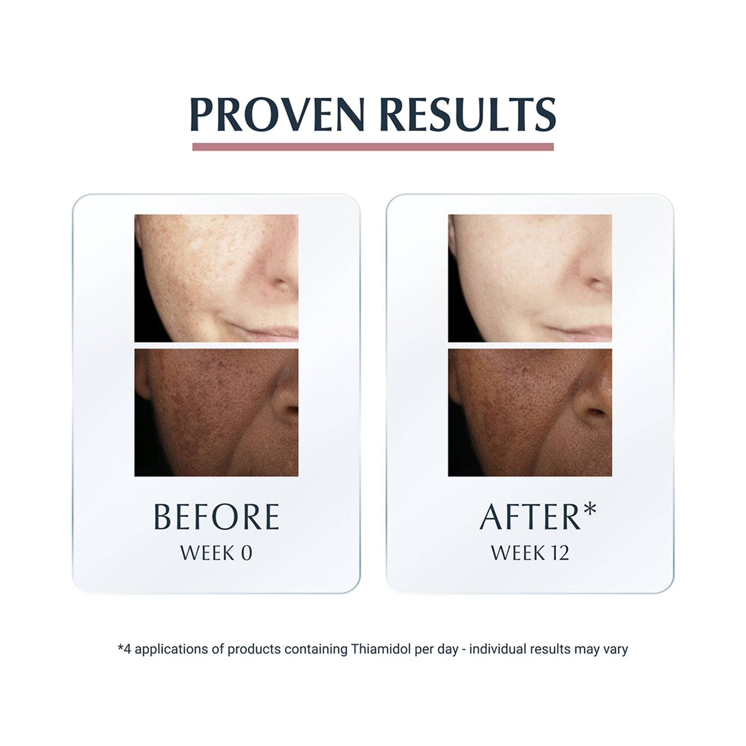Eucerin Anti-Pigment Dual Serum 30ml