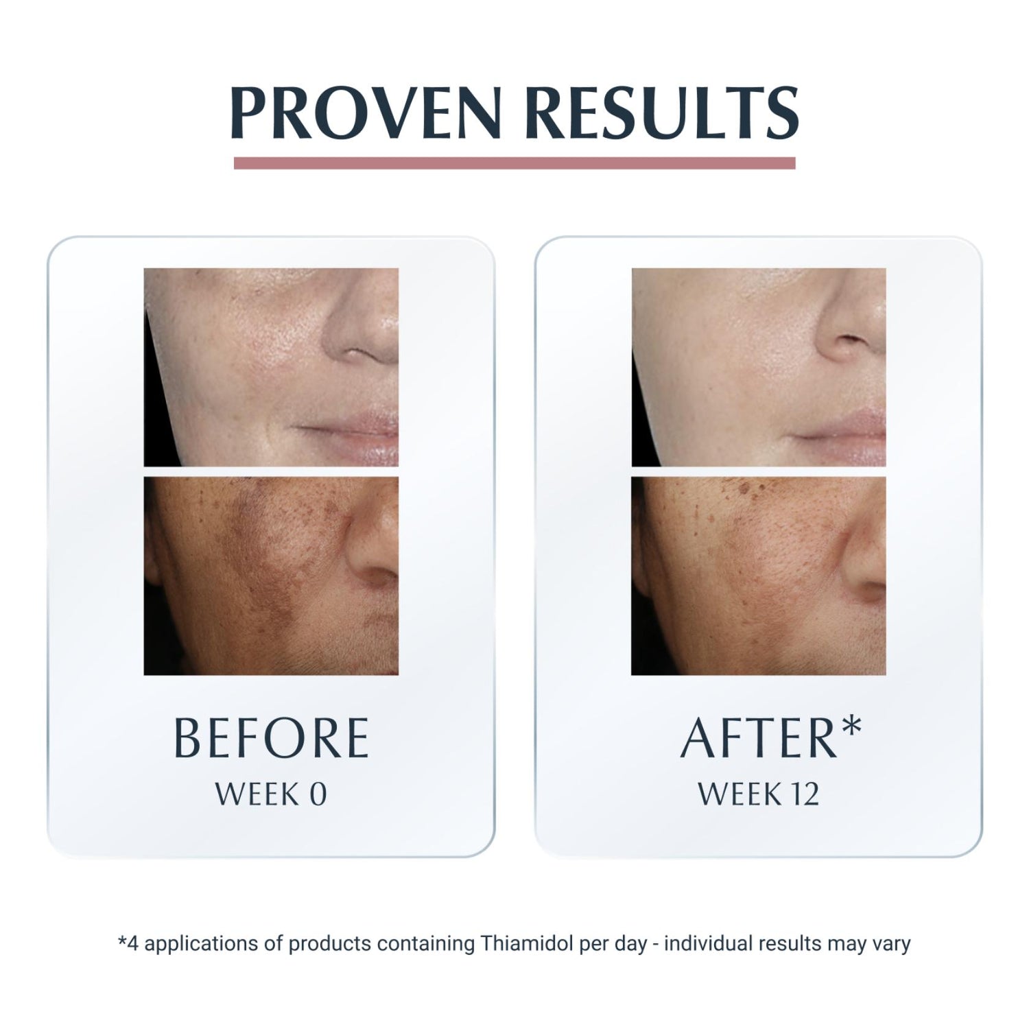 Eucerin Anti-Pigment Spot Corrector 5ml