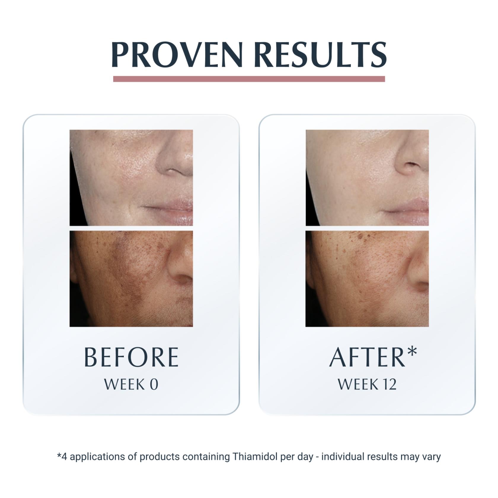 Eucerin Anti-Pigment Spot Corrector 5ml