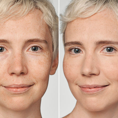 Clinique Even Better Clinical Foundation SPF20 