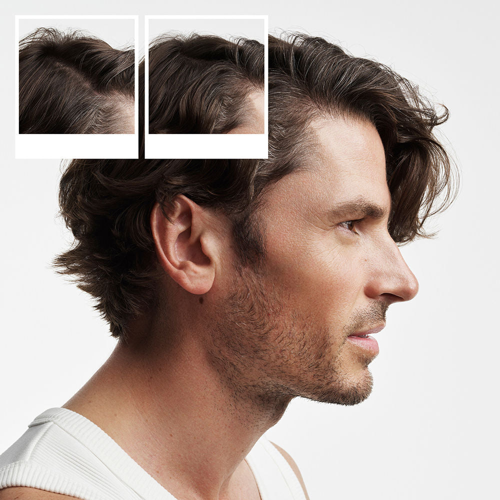 Nioxin System 2 - Kit - Treatment for Natural Hair with Advanced Weakening 3 Units