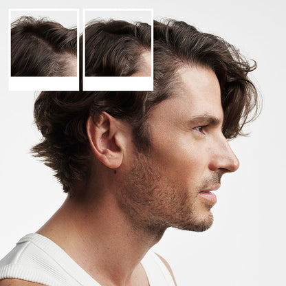 Nioxin System 2 - Kit - Treatment for Natural Hair with Advanced Weakening 3 Units