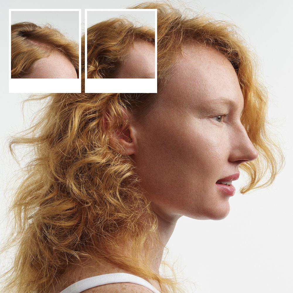 Nioxin System 4 - Kit - Treatment for Colored Hair with Advanced Thinning 3 Units
